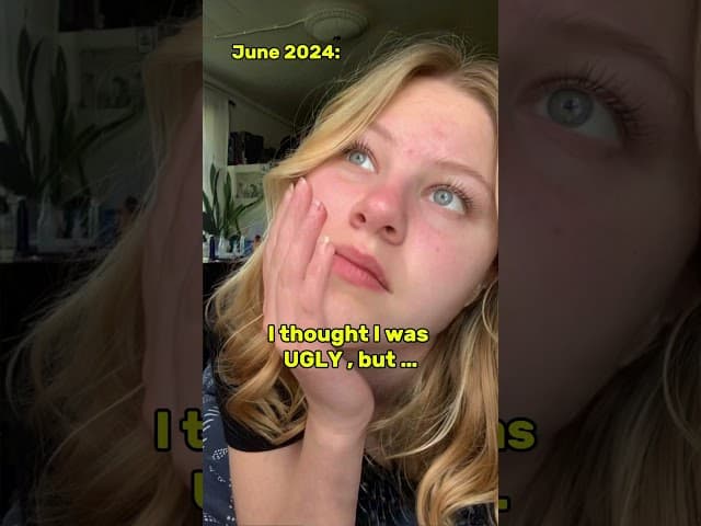 30 day mewing transformation (real results)